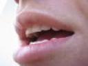 33395_mouth.jpg